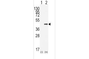 Western blot analysis of CDX2(arrow) using rabbit polyclonal CDX2 Antibody (N-term) (ABIN390076 and ABIN2840597). (CDX2 抗体  (N-Term))