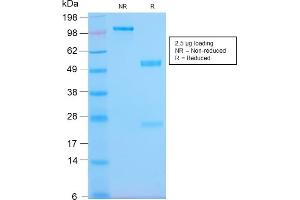 SDS-PAGE (SDS) image for anti-MHC Class II HLA-DP/DQ/DR (HLA-DP/DQ/DR) antibody (ABIN6941452)