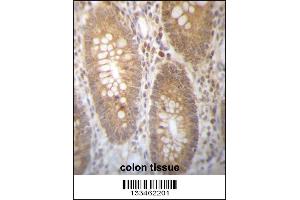 DHRS7B Antibody immunohistochemistry analysis in formalin fixed and paraffin embedded human colon tissue followed by peroxidase conjugation of the secondary antibody and DAB staining. (DHRS7B 抗体  (AA 133-161))