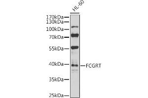 Western blot analysis of extracts of HL-60 cells, using FCGRT antibody (ABIN6127922, ABIN6140552, ABIN6140553 and ABIN6224639) at 1:1000 dilution. (FcRn 抗体  (AA 25-300))