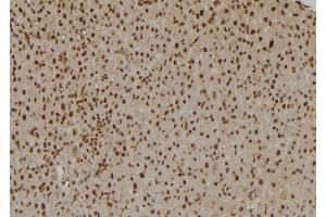 ABIN6257992 and ABIN6275831 at 1/100 staining Rat liver tissue by IHC-P. (TRAF2 抗体  (C-Term))
