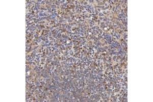 IHC analysis of Mitochondrial Dicarboxylate Carrier/SLC25A10 using anti-Mitochondrial Dicarboxylate Carrier/SLC25A10 antibody (ABIN7601497).