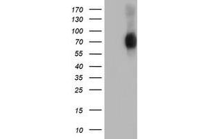 Western Blotting (WB) image for anti-SH2B Adaptor Protein 3 (SH2B3) antibody (ABIN1500910) (SH2B3 抗体)