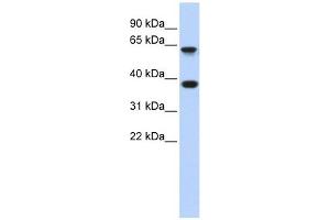 Epsin 2 antibody used at 1 ug/ml to detect target protein. (Epsin 2 抗体  (Middle Region))