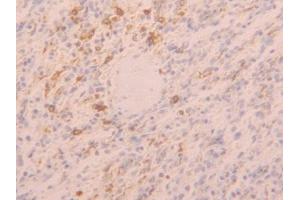 IHC-P analysis of Human Spleen Tissue, with DAB staining. (TLR5 抗体  (AA 693-858))