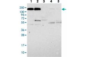 Western blot analysis of Lane 1: RT-4, Lane 2: U-251 MG, Lane 3: Human Plasma, Lane 4: Liver, Lane 5: Tonsil with DOCK3 polyclonal antibody  at 1:250-1:500 dilution. (DOCK3 抗体)