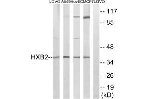 Western blot analysis of extracts from LOVO cells, A549 cells, HUVEC cells and MCF-7 cells, using HOXB2 antibody. (HOXB2 抗体  (Internal Region))