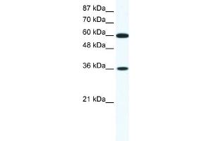 WB Suggested Anti-FOXF1 Antibody Titration: 1. (FOXF1 抗体  (N-Term))