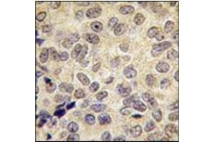 Image no. 3 for anti-DNA (Cytosine-5-)-Methyltransferase 3 beta (DNMT3B) (Middle Region) antibody (ABIN356569) (DNMT3B 抗体  (Middle Region))