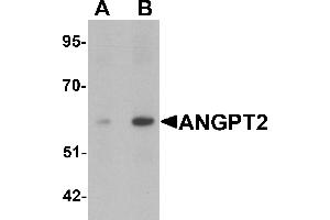 Western blot analysis of ANGPT2 in human liver tissue lysate with ANGPT2 antibody at (A) 1 and (B) 2 µg/mL.