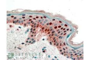 ABIN185539 (2. (14-3-3 sigma/SFN 抗体  (Internal Region))