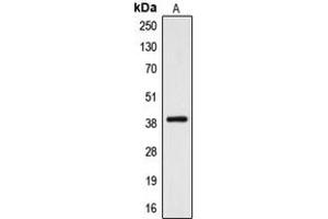 Western blot analysis of CYSLTR2 expression in A10 (A) whole cell lysates.
