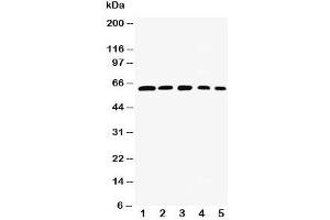 Western blot testing of RelB antibody and Lane 1:  rat testis;  2: (h) HeLa;  3: (m) NIH3T3;  4: (h) Raji;  5: (m) HEPA cell lysate.