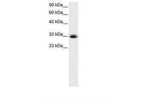 Image no. 1 for anti-Retina and Anterior Neural Fold Homeobox (RAX) (N-Term) antibody (ABIN6735790) (RAX 抗体  (N-Term))