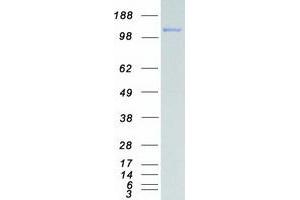 Western Blotting (WB) image for BMP2 Inducible Kinase (BMP2K) (Transcript Variant 1) protein (Myc-DYKDDDDK Tag) (ABIN2715298)
