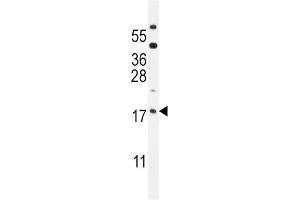 Western Blotting (WB) image for anti-ORM1-Like 3 (ORMDL3) antibody (ABIN2995811) (ORMDL3 抗体)