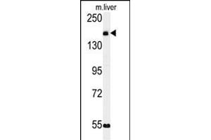 Western blot analysis of KI Antibody (C-term) (ABIN651358 and ABIN2840200) in mouse liver tissue lysates (35 μg/lane). (CCDC180 抗体  (C-Term))