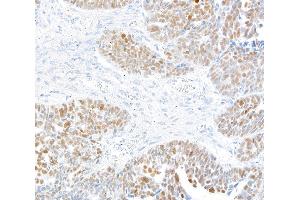 Immunohistochemistry (IHC) image for anti-Kruppel-Like Factor 5 (Intestinal) (KLF5) (AA 325-375) antibody (ABIN7795630) (Recombinant KLF5 抗体  (AA 325-375))