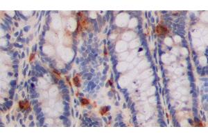Detection of 5-HT in Rat Colon Tissue using Polyclonal Antibody to 5-Hydroxytryptamine (5-HT) (Serotonin 抗体)