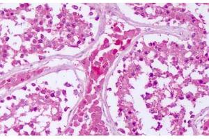 Anti-PTPRE antibody IHC staining of human testis. (PTPRE 抗体  (Cytoplasmic Domain))