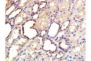 Formalin-fixed and paraffin embedded human kidney labeled with Anti ANGPTL3/ANG5 Polyclonal Antibody, Unconjugated  at 1:200 followed by conjugation to the secondary antibody and DAB staining