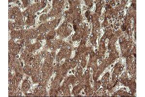 Image no. 2 for anti-serine/threonine Kinase 38 Like (STK38L) (AA 1-281) antibody (ABIN1490699) (STK38L 抗体  (AA 1-281))