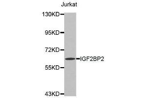 Western blot analysis of extracts of Jurkat cell line, using IGF2BP2 antibody. (IGF2BP2 抗体  (C-Term))
