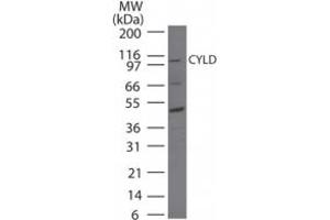 Image no. 1 for anti-Cylindromatosis (Turban Tumor Syndrome) (CYLD) (AA 32-45) antibody (ABIN200017) (CYLD 抗体  (AA 32-45))