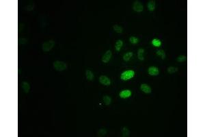 Immunofluorescence staining of Hela cells with ABIN7127742 at 1:100,counter-stained with DAPI. (Recombinant RPA2 抗体  (pThr21))