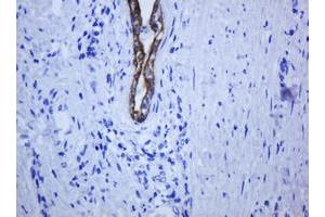 Image no. 7 for anti-Keratin 5 (KRT5) (AA 1-273) antibody (ABIN1490696) (Cytokeratin 5 抗体  (AA 1-273))