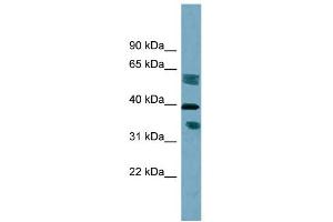 WB Suggested Anti-DHRS7B Antibody Titration:  0. (DHRS7B 抗体  (Middle Region))