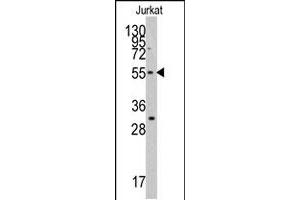 Western blot analysis of TERF1 polyclonal antibody  in Jurkat cell line lysates (35 ug/lane). (TRF1 抗体  (C-Term))