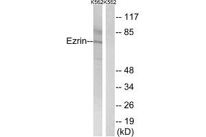 Western blot analysis of extracts from K562 cells, using Ezrin (epitope around residue 478) antibody. (Ezrin 抗体  (Tyr478))