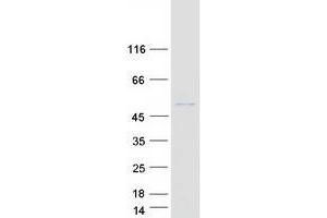 Western Blotting (WB) image for POC1 Centriolar Protein Homolog A (POC1A) protein (Myc-DYKDDDDK Tag) (ABIN2735520)