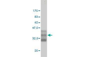 Western Blot detection against Immunogen (35. (CDK13 抗体  (AA 1-90))