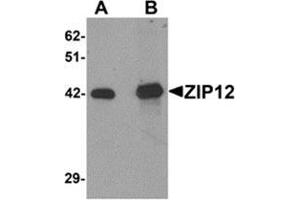 Western Blotting (WB) image for anti-Solute Carrier Family 39 (Zinc Transporter), Member 12 (SLC39A12) (N-Term) antibody (ABIN783813)