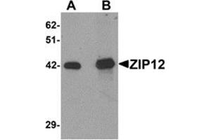 Western blot analysis of ZIP12 in HepG2 cell lysate with ZIP12 antibody at (A) 0. (SLC39A12 抗体  (N-Term))