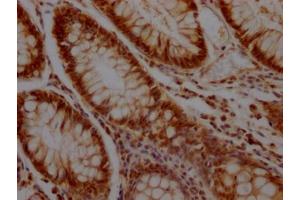 Immunohistochemistry (IHC) image for anti-Kruppel-Like Factor 4 (Gut) (KLF4) antibody (ABIN7127591)