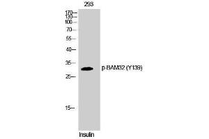 Western Blotting (WB) image for anti-Dual Adaptor of Phosphotyrosine and 3-phosphoinositides (DAPP1) (pTyr139) antibody (ABIN3179600) (DAPP1 抗体  (pTyr139))