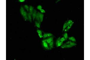 Immunofluorescent analysis of Hela cells using SGO1 antibody at a dilution of 1:100 and Alexa Fluor 488-conjugated Goat Anti-Rabbit IgG antibody. (Shugoshin 抗体  (AA 260-439))