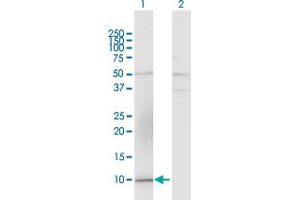 Western Blot analysis of CCL15 expression in transfected 293T cell line by CCL15 MaxPab polyclonal antibody. (CCL15 抗体  (AA 1-113))