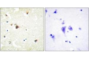 Immunohistochemistry analysis of paraffin-embedded human brain tissue, using TRIM3 Antibody. (TRIM3 抗体  (AA 1-50))