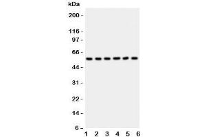 Western blot testing of AKT2 antibody and Lane 1:  HeLa;  2: PANC;  3: A549;  4: COLO320;  5: HT1080;  6: MCF-7 lysate (AKT2 抗体  (C-Term))