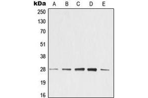 Western blot analysis of 14-3-3 zeta expression in KNRK (A), NIH3T3 (B), C4 (C), EOC20 (D), CTLL2 (E) whole cell lysates. (14-3-3 zeta 抗体  (Center))