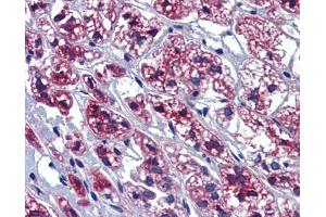 Immunohistochemistry (IHC) image for anti-GTP-Binding Protein 10 (GTPBP10) (Middle Region) antibody (ABIN2773813) (GTPBP10 抗体  (Middle Region))