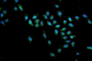 IF analysis of SMN1/2 using anti-SMN1/2 antibody (ABIN3043933).