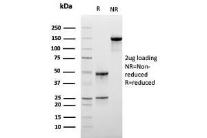 SDS-PAGE Analysis Purified Monospecific Mouse Monoclonal Antibody to LSP1 (LSP1/3025). (LSP1 抗体  (AA 174-278))