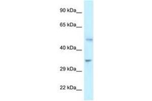 Image no. 1 for anti-6-phosphofructo-2-Kinase/fructose-2,6-Biphosphatase 1 (PFKFB1) (C-Term) antibody (ABIN6747349) (PFKFB1 抗体  (C-Term))