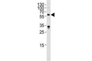 Western blot analysis of lysate from HepG2 cell line using IL1R1 antibody diluted at 1:1000. (IL1R1 抗体  (AA 474-503))