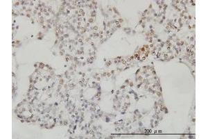 Image no. 3 for anti-Sestrin 2 (SESN2) (AA 1-481) antibody (ABIN466250) (Sestrin 2 抗体  (AA 1-481))